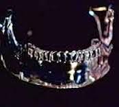 Хрустальные черепа