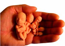 Государственная поддержка абортов – узаконенный геноцид